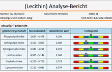 Lade das Bild in den Galerie-Viewer, Software Quanten Resonanz Magnetischer Analysator Version 2024 plus (Cloud, Autark) Deutsch mit Dongle